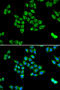 PCB antibody, STJ28223, St John