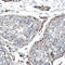 Shiftless Antiviral Inhibitor Of Ribosomal Frameshifting antibody, HPA042001, Atlas Antibodies, Immunohistochemistry paraffin image 