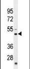 RNA Binding Motif Protein 43 antibody, PA5-24106, Invitrogen Antibodies, Western Blot image 