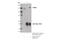 Histone Deacetylase 5 antibody, 20458S, Cell Signaling Technology, Immunoprecipitation image 