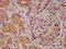 Phosphatidylinositol Binding Clathrin Assembly Protein antibody, LS-C671984, Lifespan Biosciences, Immunohistochemistry paraffin image 
