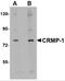 Dihydropyrimidinase-related protein 1 antibody, 4983, ProSci Inc, Western Blot image 