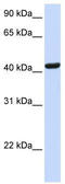 Src Kinase Associated Phosphoprotein 1 antibody, TA338987, Origene, Western Blot image 