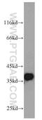 Regulation of nuclear pre-mRNA domain-containing protein 1A antibody, 23652-1-AP, Proteintech Group, Western Blot image 
