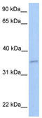 NFKB Inhibitor Interacting Ras Like 2 antibody, TA336204, Origene, Western Blot image 