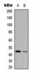Sirtuin 3 antibody, orb393163, Biorbyt, Western Blot image 
