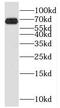 Matrix Metallopeptidase 21 antibody, FNab05240, FineTest, Western Blot image 