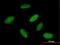 RNA Binding Motif Protein 23 antibody, H00055147-B01P, Novus Biologicals, Immunofluorescence image 
