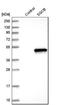 Sarcoglycan Beta antibody, NBP1-90300, Novus Biologicals, Western Blot image 