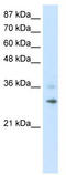 Ring Finger Protein 113B antibody, TA345612, Origene, Western Blot image 