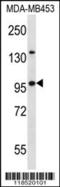 Nucleoporin 88 antibody, 57-528, ProSci, Western Blot image 