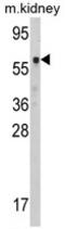 Cystathionine beta-synthase antibody, AP17189PU-N, Origene, Western Blot image 