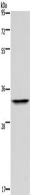 Acidic Nuclear Phosphoprotein 32 Family Member E antibody, TA351339, Origene, Western Blot image 