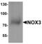 NADPH Oxidase 3 antibody, MBS153341, MyBioSource, Western Blot image 