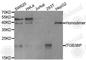 Integrin Subunit Beta 3 Binding Protein antibody, A5839, ABclonal Technology, Western Blot image 