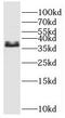 Endonuclease, Poly(U) Specific antibody, FNab06654, FineTest, Western Blot image 