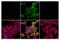 Receptor Interacting Serine/Threonine Kinase 1 antibody, 44590S, Cell Signaling Technology, Immunocytochemistry image 