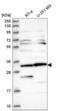 Clusterin Associated Protein 1 antibody, NBP2-58124, Novus Biologicals, Western Blot image 