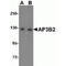Adaptor Related Protein Complex 3 Subunit Beta 2 antibody, TA319743, Origene, Western Blot image 