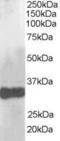 Claudin 14 antibody, TA302811, Origene, Western Blot image 