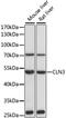 CLN3 Lysosomal/Endosomal Transmembrane Protein, Battenin antibody, 18-394, ProSci, Western Blot image 