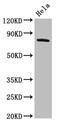 G Protein-Coupled Receptor Kinase 3 antibody, CSB-PA001395LA01HU, Cusabio, Western Blot image 