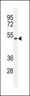 FAD Dependent Oxidoreductase Domain Containing 1 antibody, 64-052, ProSci, Western Blot image 