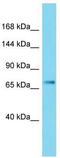 Janus Kinase 3 antibody, TA336237, Origene, Western Blot image 
