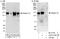 Integrin Subunit Beta 1 antibody, A303-735A, Bethyl Labs, Western Blot image 