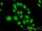 ATF4 antibody, H00000468-M01, Novus Biologicals, Immunofluorescence image 
