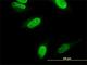 CaRF antibody, H00055602-M04, Novus Biologicals, Immunofluorescence image 