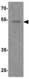 Forkhead Box G1 antibody, GTX17231, GeneTex, Western Blot image 