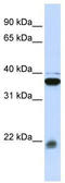 20 kDa myosin light chain antibody, TA346605, Origene, Western Blot image 
