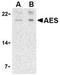 Amino-terminal enhancer of split antibody, TA306254, Origene, Western Blot image 