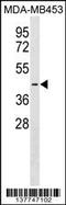 Pejvakin antibody, 59-625, ProSci, Western Blot image 