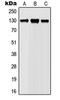 Janus Kinase 1 antibody, MBS821826, MyBioSource, Western Blot image 