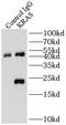 KRAS Proto-Oncogene, GTPase antibody, FNab04641, FineTest, Immunoprecipitation image 