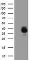 LRAT Domain Containing 2 antibody, TA501922, Origene, Western Blot image 