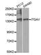 Integrin Subunit Alpha V antibody, LS-B11920, Lifespan Biosciences, Western Blot image 