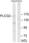 Phospholipase C Gamma 2 antibody, LS-B6989, Lifespan Biosciences, Western Blot image 