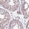 Notch Receptor 2 antibody, HPA048743, Atlas Antibodies, Immunohistochemistry frozen image 