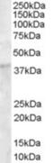 Dickkopf WNT Signaling Pathway Inhibitor 1 antibody, orb18888, Biorbyt, Western Blot image 