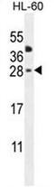 C-Type Lectin Domain Family 2 Member A antibody, AP50960PU-N, Origene, Western Blot image 