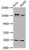 ATP-dependent DNA helicase Q4 antibody, CSB-PA019538LA01HU, Cusabio, Western Blot image 