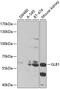 Galactosidase Beta 1 antibody, 15-136, ProSci, Western Blot image 