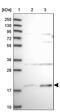 Solute Carrier Family 41 Member 3 antibody, PA5-61106, Invitrogen Antibodies, Western Blot image 