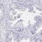 Leucine Rich Repeat Containing 23 antibody, HPA057533, Atlas Antibodies, Immunohistochemistry paraffin image 