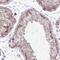 PARD6A antibody, NBP2-38487, Novus Biologicals, Immunohistochemistry paraffin image 