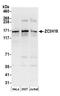 Zinc Finger CCCH-Type Containing 18 antibody, A304-682A, Bethyl Labs, Western Blot image 