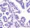 Dicer 1, Ribonuclease III antibody, PA5-23088, Invitrogen Antibodies, Immunohistochemistry paraffin image 
